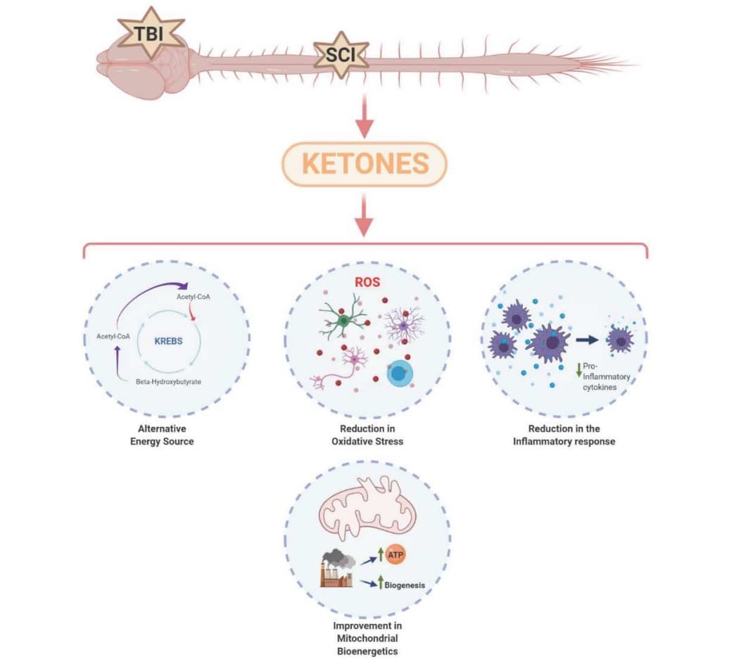 Ketogenic regimens for acute neurotraumatic events
